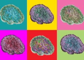 Brain changes Alzheimer's Kenneth Rostowsky