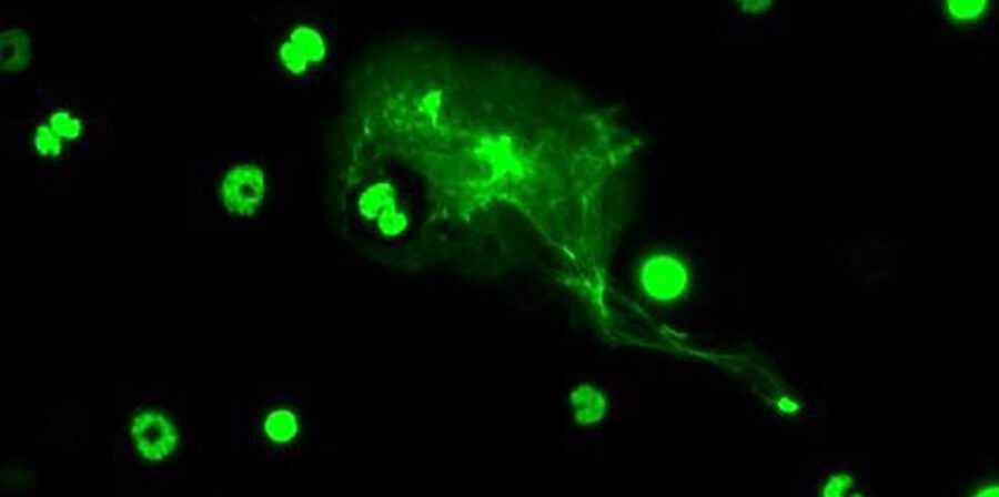 Image of a neutrophil undergoing NETosis, expelling chromatin to ensnare and destroy a pathogen (Ryan Lu/Benayoun Lab)