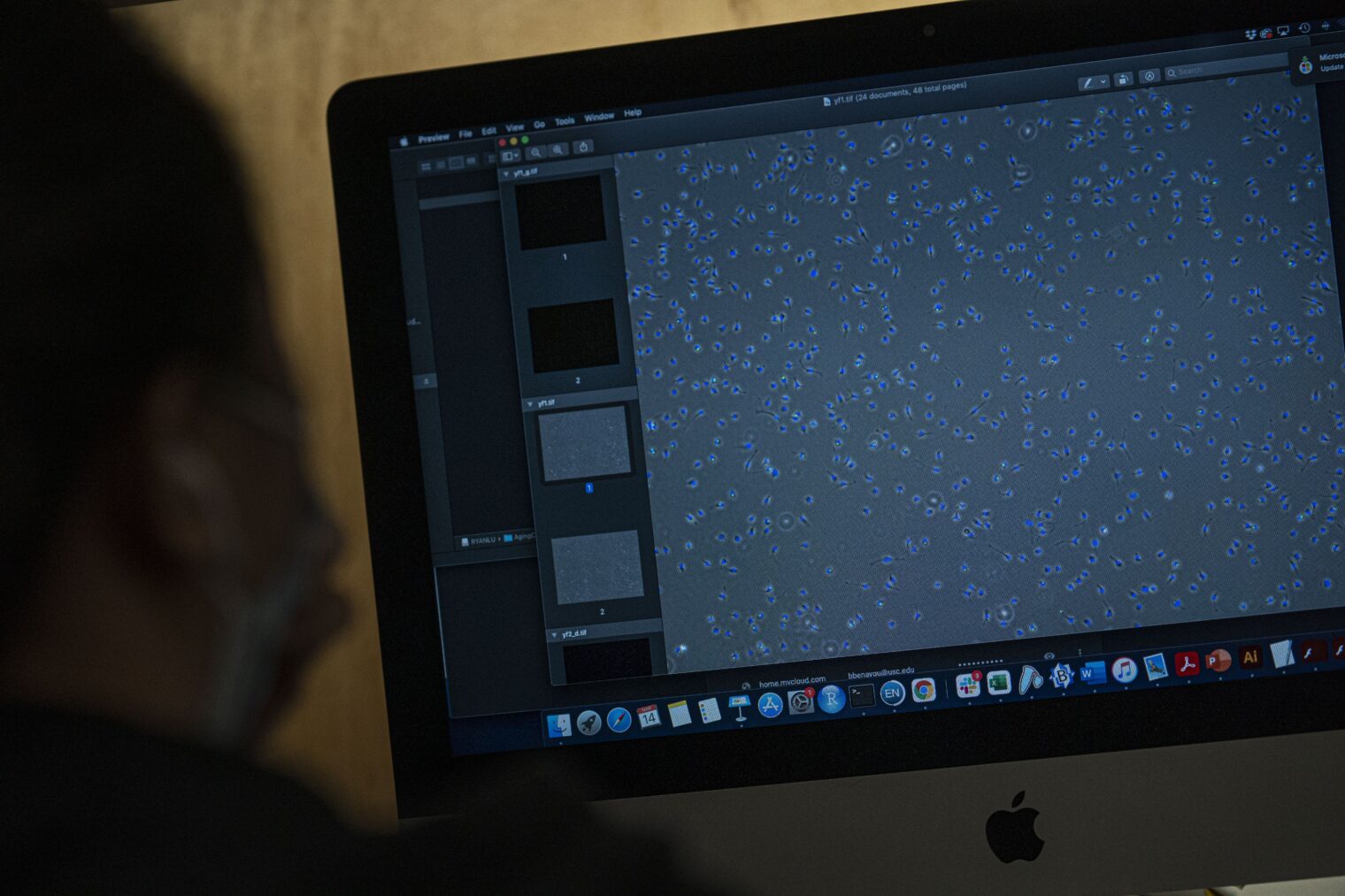 Person looks at cells on computer monitor