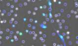 A neutrophil undergoes NETosis, expelling chromatin to ensnare and destroy a pathogen (Ryan Lu/Benayoun Lab)