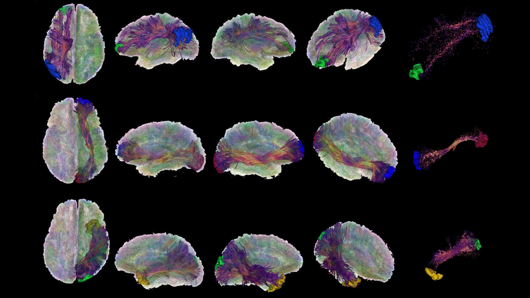 Brain scan displaying various sections of the brain